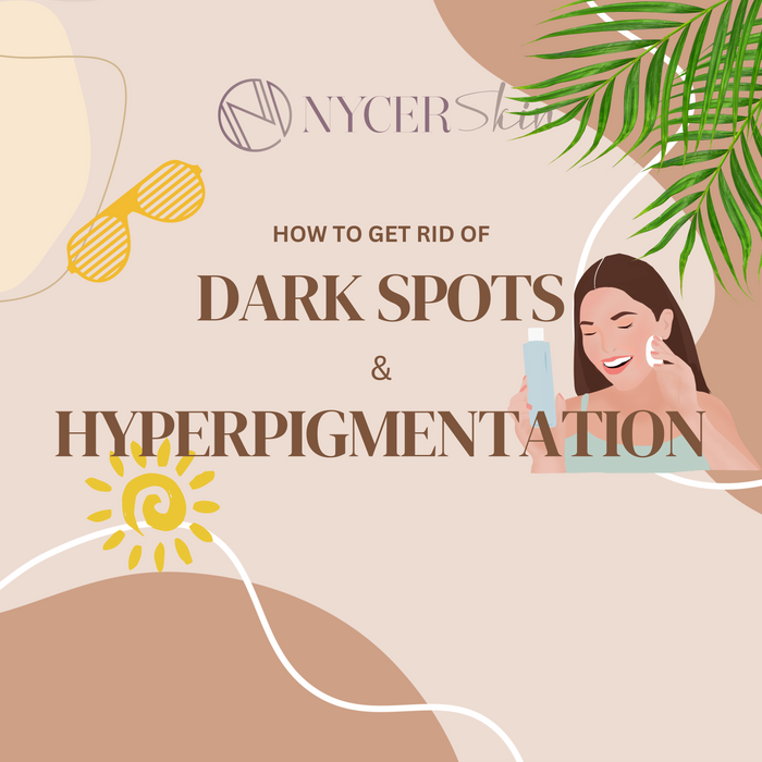 How To Get Rid Of Dark Spots Or Hyperpigmentation